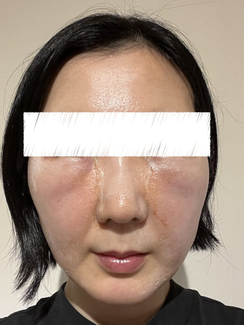 40代 裏ハムラ 体験談