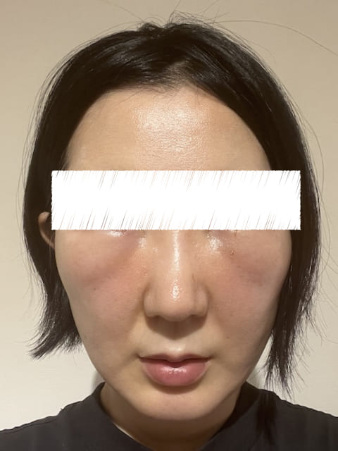 裏ハムラ 体験ブログ