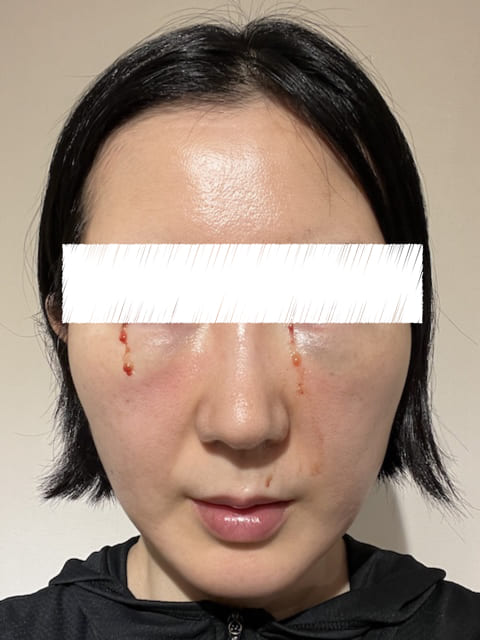 裏ハムラ プリモ麻布十番クリニック 体験