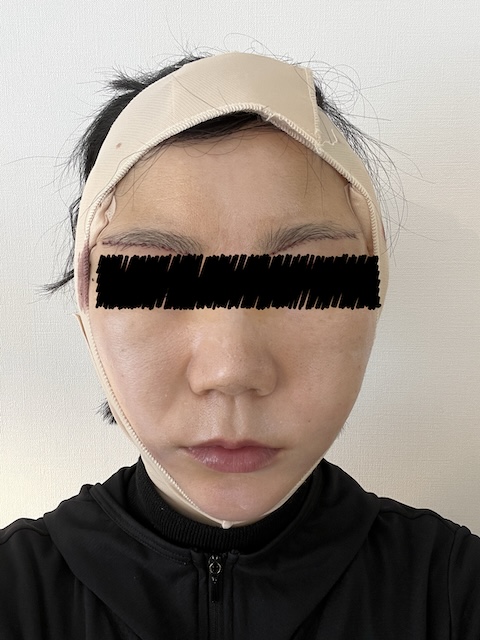 術後1日目の様子
